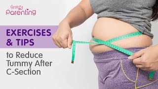 How to Reduce Tummy Fat After Csection Delivery Easy Exercises amp Tips [upl. by Eillim863]