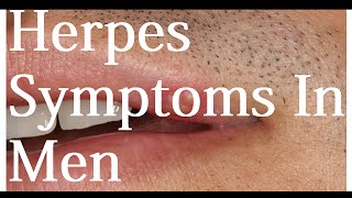 Herpes Symptoms In Men [upl. by Ikaz]