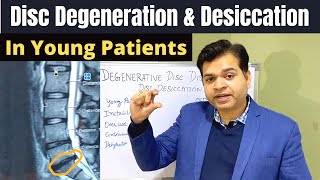 Disc Degeneration L5 S1 Disc Desiccation Disc Degeneration Causes DDDDegenerative Disc Treatment [upl. by Utley252]