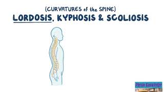 Severe Scoliosis amp Kyphosis  Advanced Technique For A Spine In Critical Condition Chiropractic 47 [upl. by Ertha]