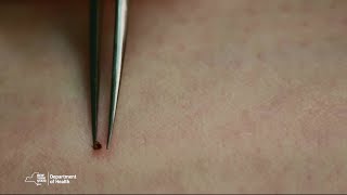 Proper Tick Removal [upl. by Pardew]