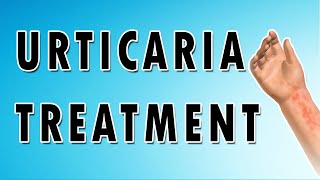 Urticaria Symptoms Treatment and Causes [upl. by Bethany]