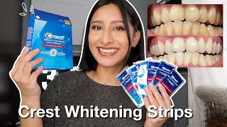 I TRIED THE CREST 3D WHITESTRIPS FOR 14 DAYS Effective  Before amp After pictures [upl. by Aramanta410]