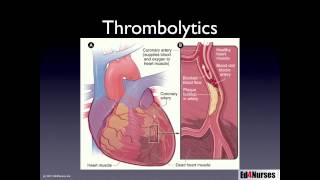 Percutaneous Coronary Interventions [upl. by Ethelda]