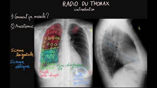 Radio du thorax  Introduction  Partie 1  Docteur Synapse [upl. by Lydon]