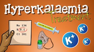 Hyperkalemia Treatment [upl. by Lraep664]