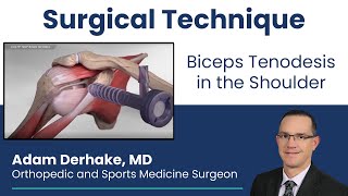 Biceps Tenodesis in the Shoulder Surgical Technique [upl. by Lorak]