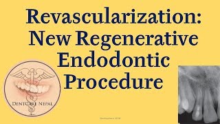 Abdominal Vasculature  Dissection Supplement [upl. by Aracahs]