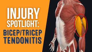 Injury Spotlight Bicep amp Tricep Tendonitis [upl. by Osmund464]