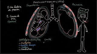 Pneumothorax  Docteur Synapse [upl. by Sluiter]