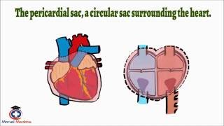 Cardiac Tamponade Pulsus Paradoxus [upl. by Assylla849]