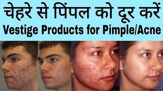 Vestige Products For AcnePimple  Vestige Skin Care Products [upl. by Meit]