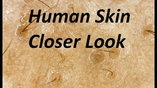 A Closer Look At Human Skin Under Microscope [upl. by Louanne927]