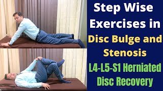 Exercises For Herniated Disc Disc Bulge L4L5S1 Step Wise Treatment for Slipped Disc Recovery [upl. by Gabe]