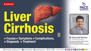 EndStage Liver Disease Score amp Peritonitis in Patients With Cirrhosis [upl. by Paulo]