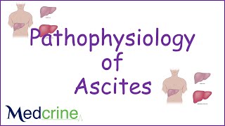 pathophysiology of ascites [upl. by Melnick428]