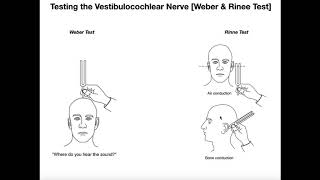 Interpreting the WeberRinne Tests EXPLAINED [upl. by Pitzer]