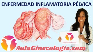 ENFERMEDAD INFLAMATORIA PÉLVICA EPI Síntomas y tratamiento  Ginecología y Obstetricia [upl. by Skricki570]