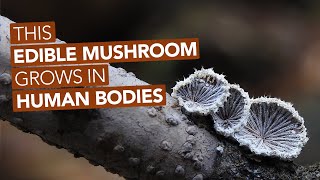 This Edible Mushroom Grows In Human Bodies [upl. by Thorndike740]