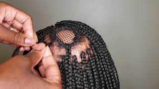 Box Braids Alopecia IGirenesbraids [upl. by Arihay]