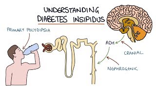 Understanding Diabetes Insipidus [upl. by Heigl161]