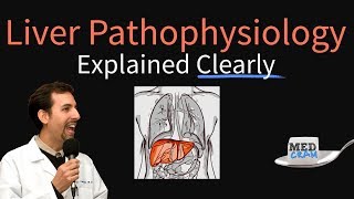 Cancer Metastasis in the Liver  All Symptoms [upl. by Morette985]