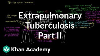 Extrapulmonary TB Part 2  Infectious diseases  NCLEXRN  Khan Academy [upl. by Berneta]