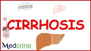 Liver Explained Clearly  Pathophysiology LFTs Hepatic Diseases [upl. by Nosille]