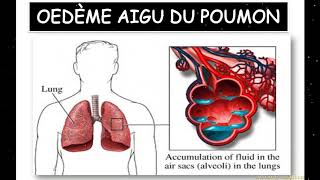 Cours pathologie médicale partie 3 [upl. by Araec328]