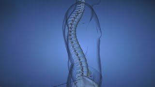 Spine Disease Kyphosis [upl. by Hackathorn]