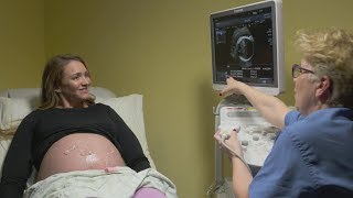 Ultrasounds during pregnancy [upl. by Jewell170]