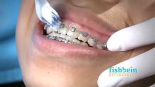 Orthodontic Home Care Instructions  Braces  Brushing [upl. by Mehala]