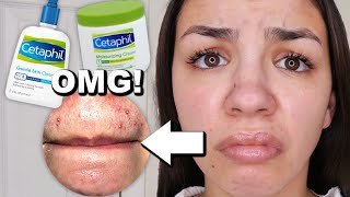 I Used Cetaphil Skincare For One Week [upl. by Minnie537]