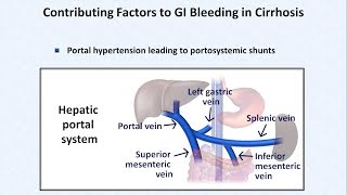 Esophageal Varices and Variceal Hemorrhage [upl. by Staten]