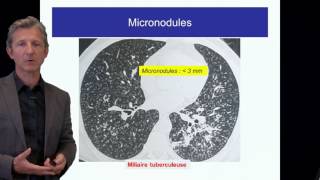 ECN PID cours 1 DFASM1 Diagnostic des PID Pr V Cottin Lyon [upl. by Iarahs]