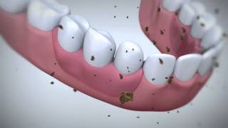 How does Fixodent denture adhesive work [upl. by Aerised396]