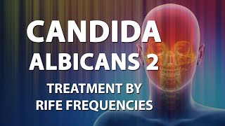 Candida Albicans 2 Candidiasis  Rife Frequencies  Energy amp Quantum Medicine  Bioresonance [upl. by Zeus842]