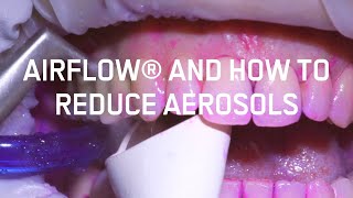 Airflow® and how to reduce aerosols [upl. by Bunch419]