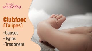 Clubfoot in babies causes treatment surgery and casting  Prof Nicola Portinaro [upl. by Ateekal]