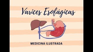 Varices Esofágicas  Anatomía Venas Estómago [upl. by Ynnol]