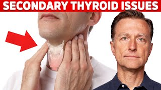 HASHIMOTOS Thyroiditis 5 Things YOU Need to Know 2024 [upl. by Zailer]