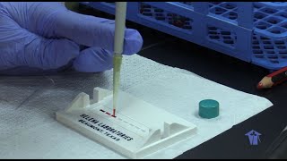 Hemoglobin Electrophoresis [upl. by Ihtraa972]