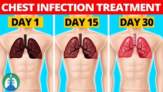 7 Natural Chest Infection Treatments Home Remedies [upl. by Mcmahon504]