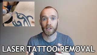 Laser Tattoo Removal  Sessions 13 Update [upl. by Anaeg]