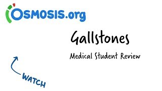 Gallstones  Clinical Presentation [upl. by Htnamas]