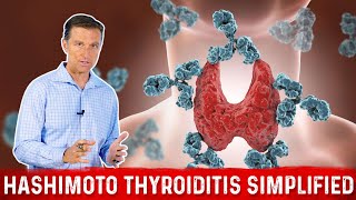 Thyroid Gland Hormones and Thyroid Problems Animation [upl. by Allerim]