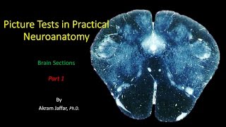 Picture Test in Neuroanatomy Brain Sections 1 [upl. by Atsyrk]