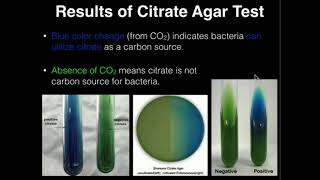 Microbiology Citrate Agar [upl. by Tegirb583]