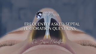 Septal Perforation Frequently Asked Questions by Dr Jason S Hamilton [upl. by Waters]