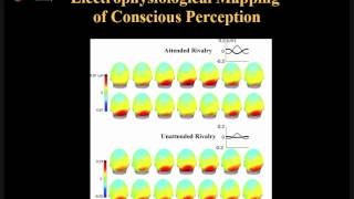 Electromyography EMG amp Nerve conduction studies NCS [upl. by Nahtaoj]